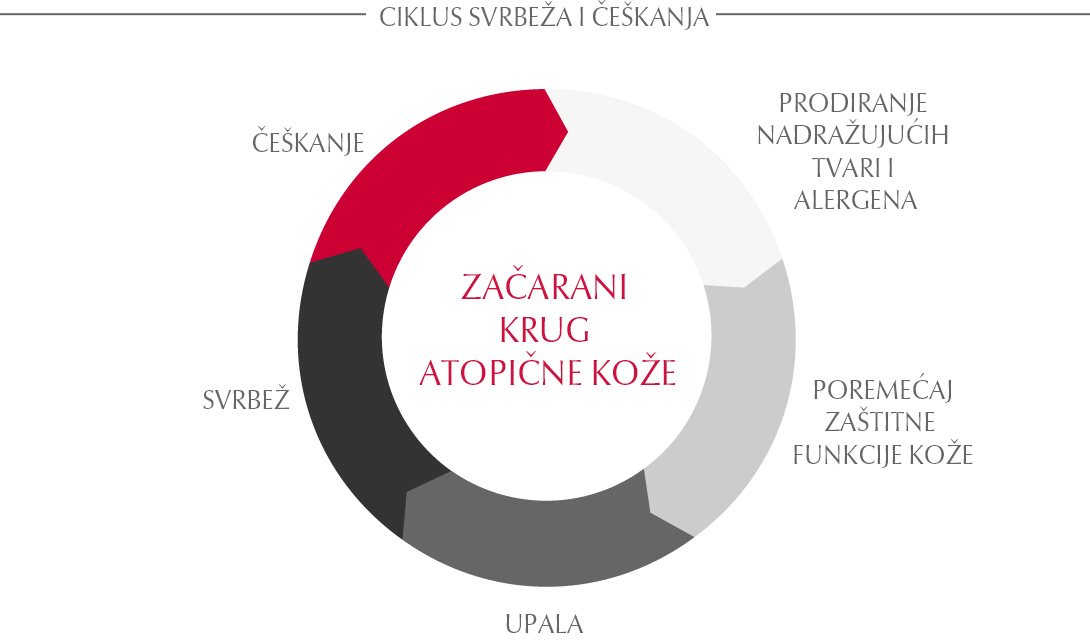 Začarani krug atopijskog dermatitisa (također poznat kao začarani krug svrbeža i češkanja)