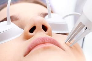 Terapija kože laserom