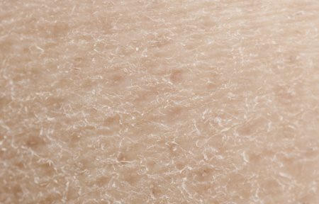 Suha koža u krupnom planu